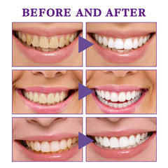 V34 Colour-Correcting Teeth Whitening Mousse